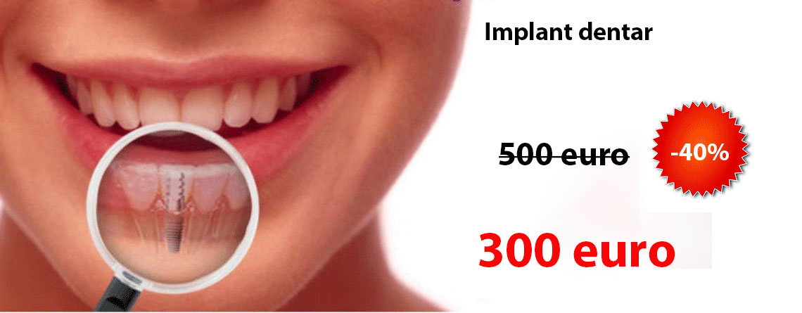 Implant dentar Alpha Bio pret 250 euro